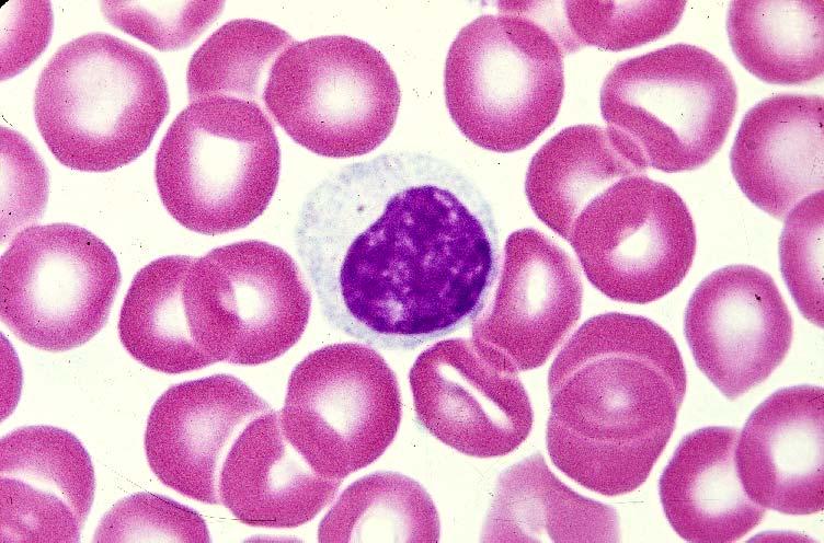 03-48. Large lymphocyte 1.