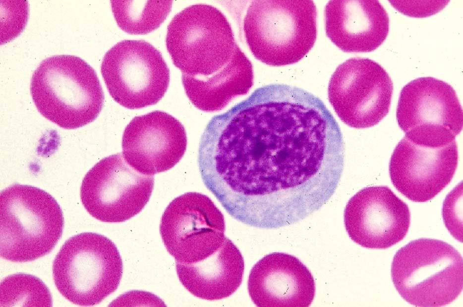 03-49. Large lymphocyte 2.