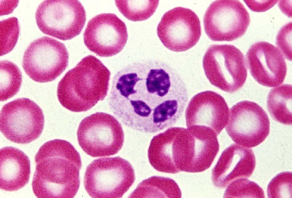 03-59. Neutrophil leucocyte 4.