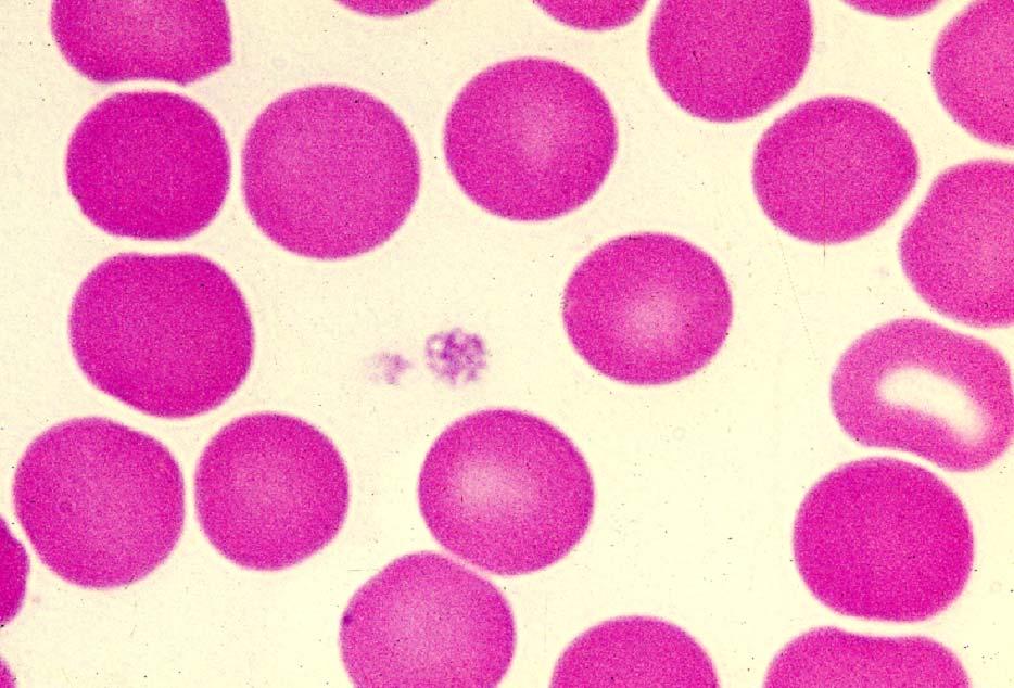 03-61. Blood platelets 1.