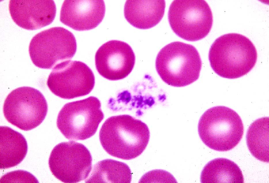 03-62. Blood platelets 2.