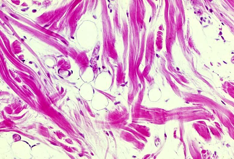 03-05. Loose connective tissue.