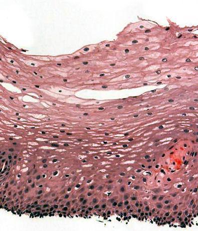 Stratified Squamous This is found on your skin (epidermis) Prevents you from bleeding out, and exploding when you go