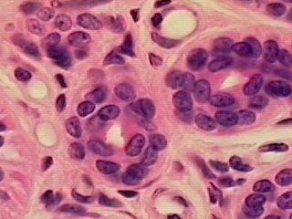 - Stratified Cuboidal: Multiple layers of cuboidal cells.