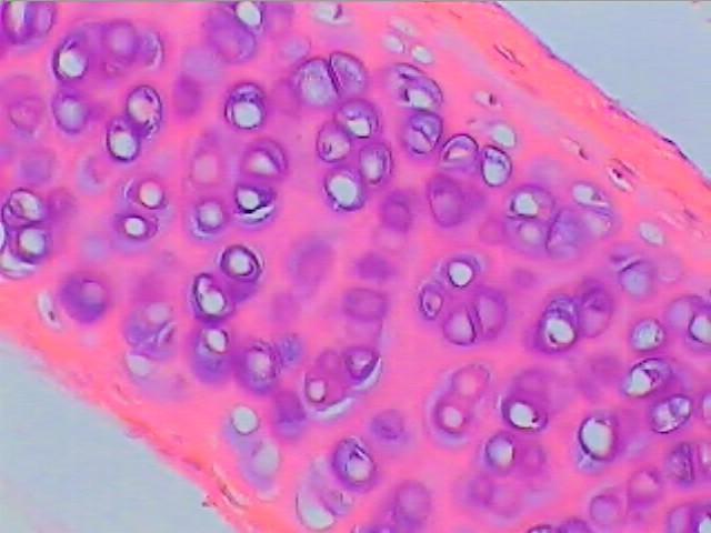 Hyaline (Glass) Most abundant form of cartilage Chondrocytes (cartilage cells) are inside