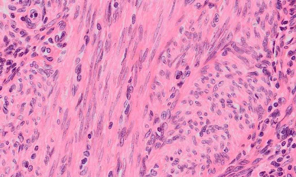 Identification Cigar-shaped nucleus centrally located in