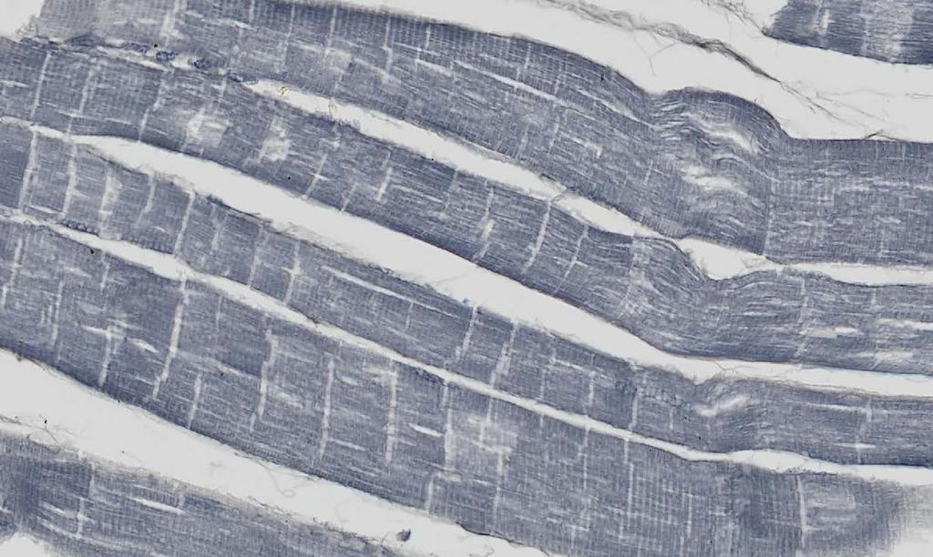 Identification Fibroblast nuclei in connective tissue sheath