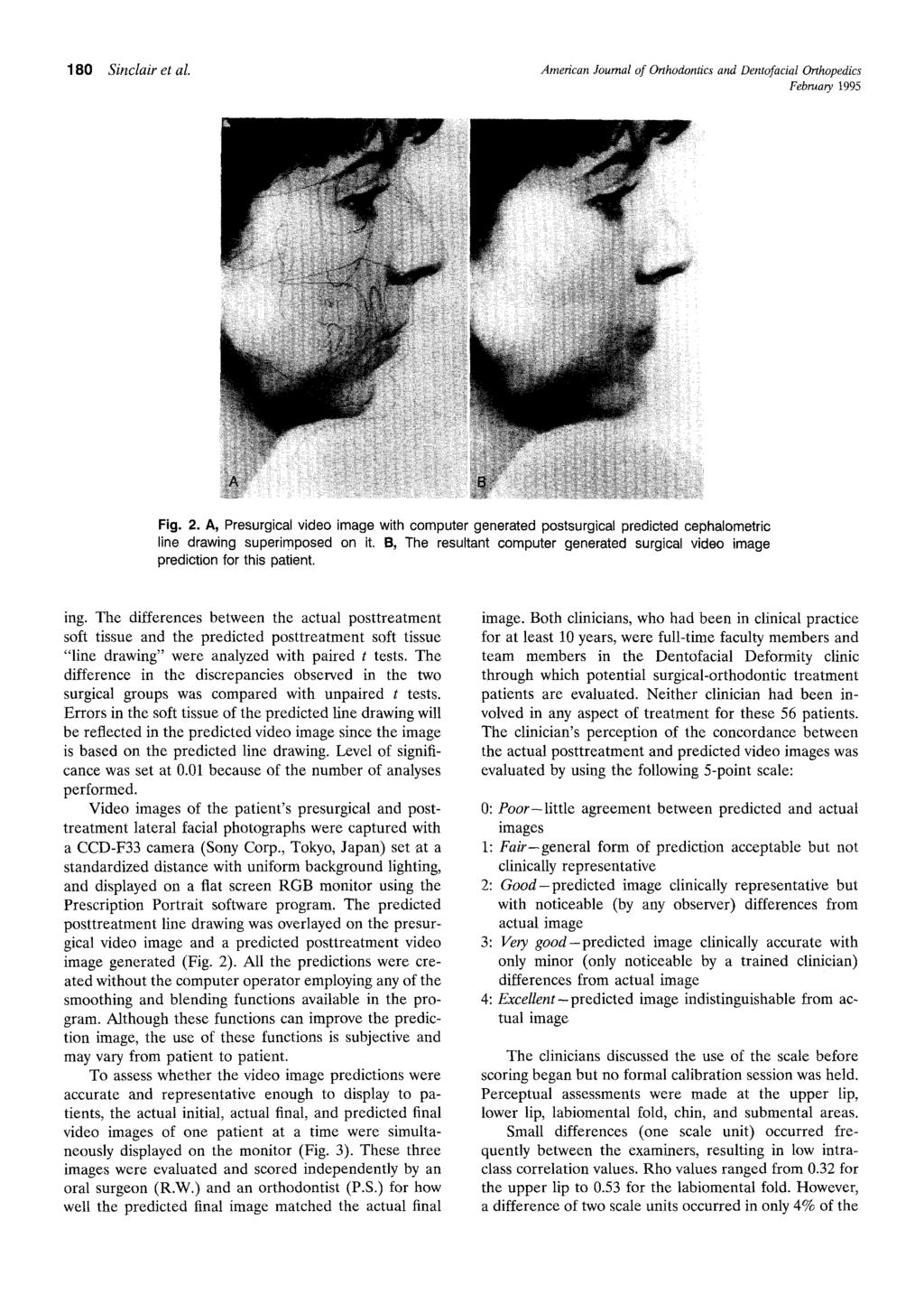 18 Sinclair et al. American Journal of Orthodontics and Dentofacial Orthopedics February 1995 Fig.