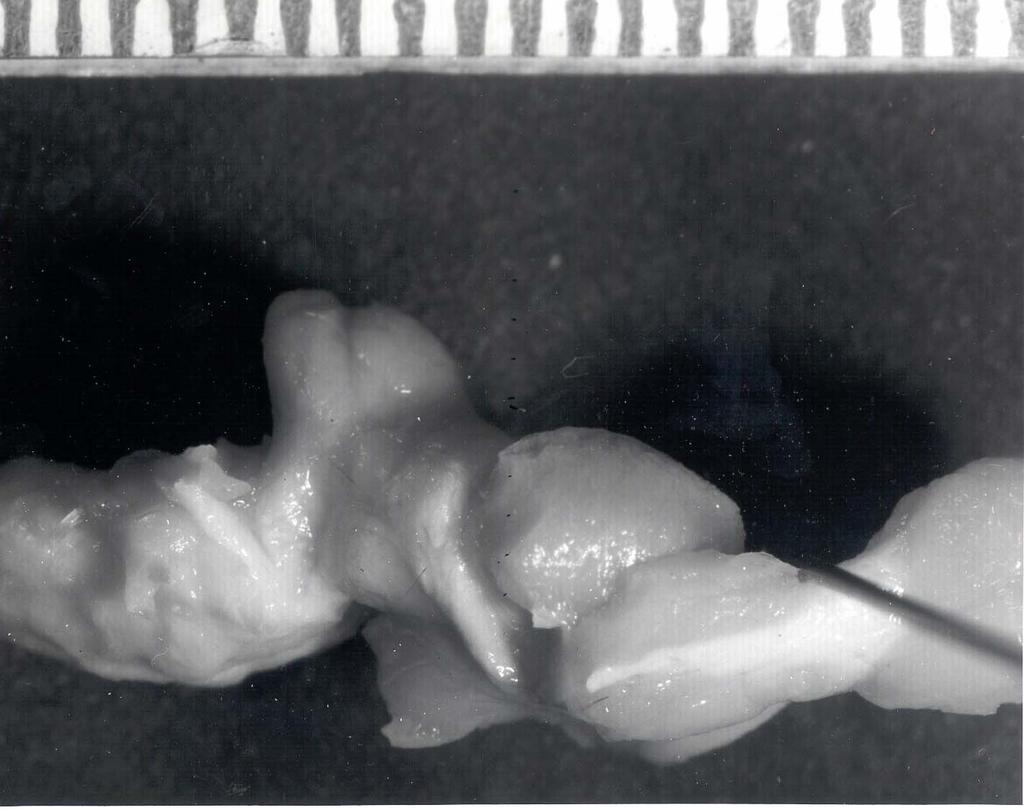 Hamster brain with hemispheres & Cb removed, seen from right side Lat