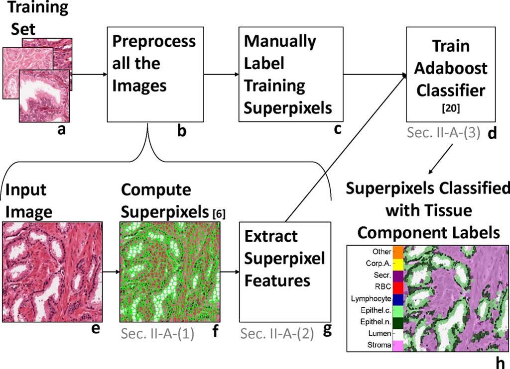 GORELICK et al.: PROSTATE HISTOPATHOLOGY: LEARNING TISSUE COMPONENT HISTOGRAMS FOR CANCER DETECTION AND CLASSIFICATION 1807 Fig. 3. Illustration of the superpixel algorithm [6].