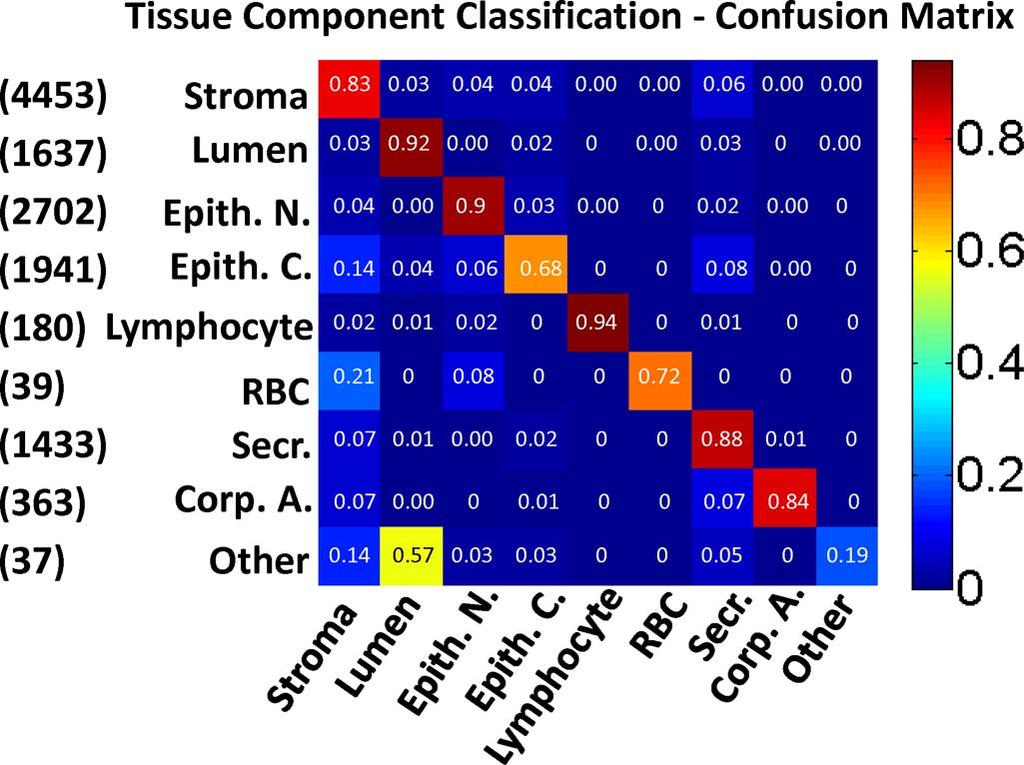 1812 IEEE TRANSACTIONS ON MEDICAL IMAGING, VOL. 32, NO. 10, OCTOBER 2013 Fig. 5. Confusion matrix for the tissue component classification: Actual labels are the rows, predicted labels are the columns.