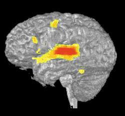 Inside the Human Brain The Brain in Action Hearing Words Speaking Words Seeing Words