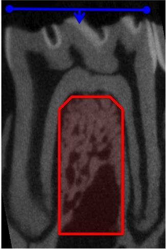 Figure 4: Sagittal slice through molar 1 (M1) of a 6 month old Sprague- Dawley rat with interradicular septum The interradicular septum is highlighted in red and extends