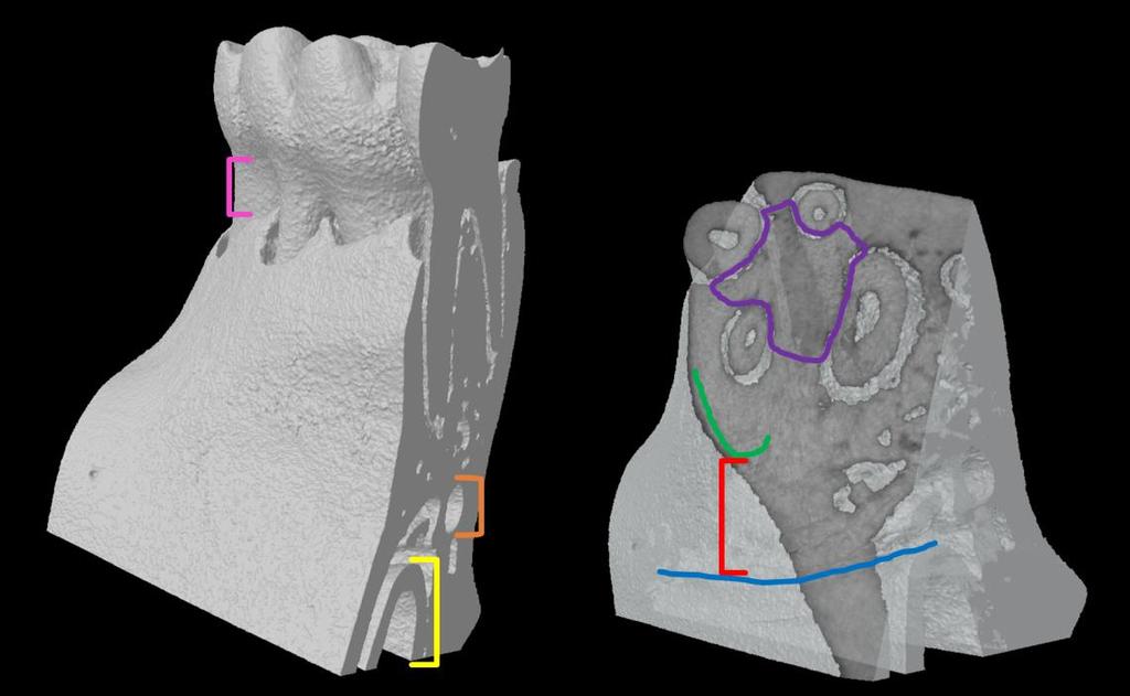 Figure 6: Landmarks to define ROI of AB at M1 M1 in its bony socket (left) with the distance between the cemento-enamel junction (CEJ) and bone crest (pink), the mandibular canal (orange), and the