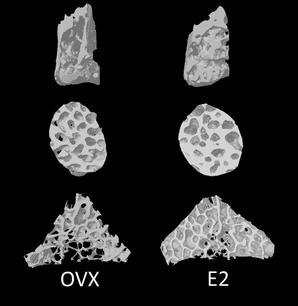 Figure 22: Representative three-dimensional models of mandibular alveolar, femoral neck, and lumbar vertebrae regions of OVX and
