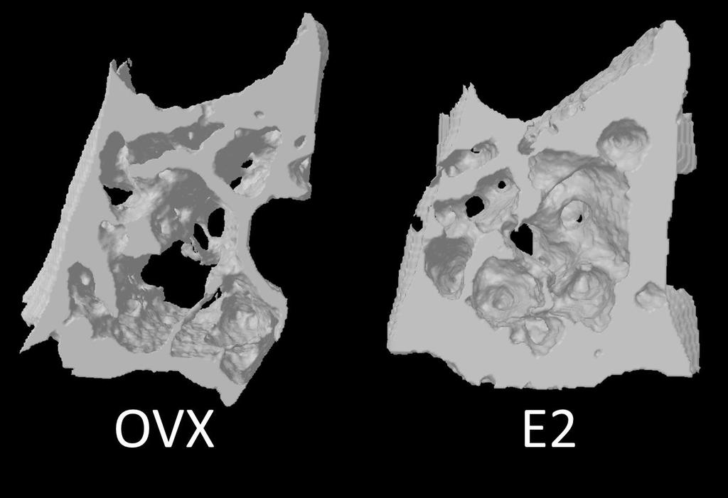 62 Figure 24: Representative three-dimensional models of the alveolar subregion of OVX and E2 treated rats The alveolar sub-region from the OVX group represents a BV/TV of 54.