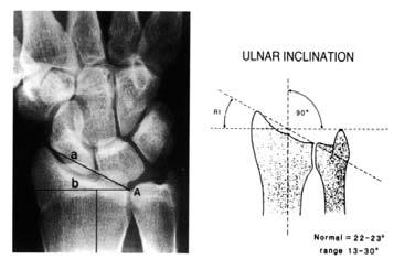 Center UW Anatomy: Radiology Ulnar (Radial)