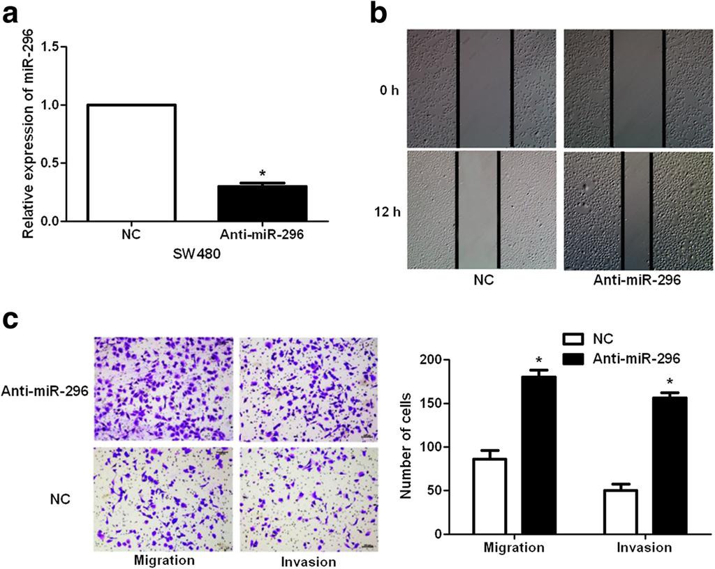 b Wound healing assays indicated that mir-296 overexpression reverses the migration of HT29 cells. c Transwell assays confirmed that mir-296 overexpression inhibited HT29 cell migration and invasion.