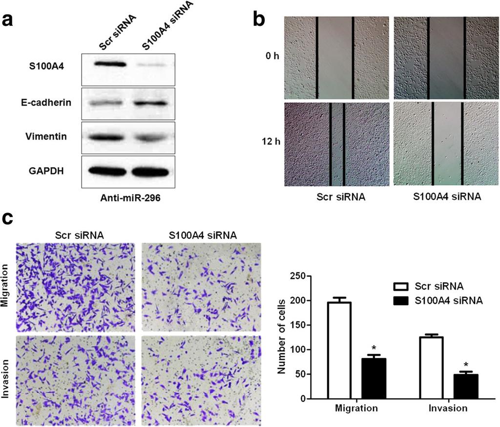 b S100A4 restoration significantly promoted the migration of mir-296 overexpressing HT29 cells.