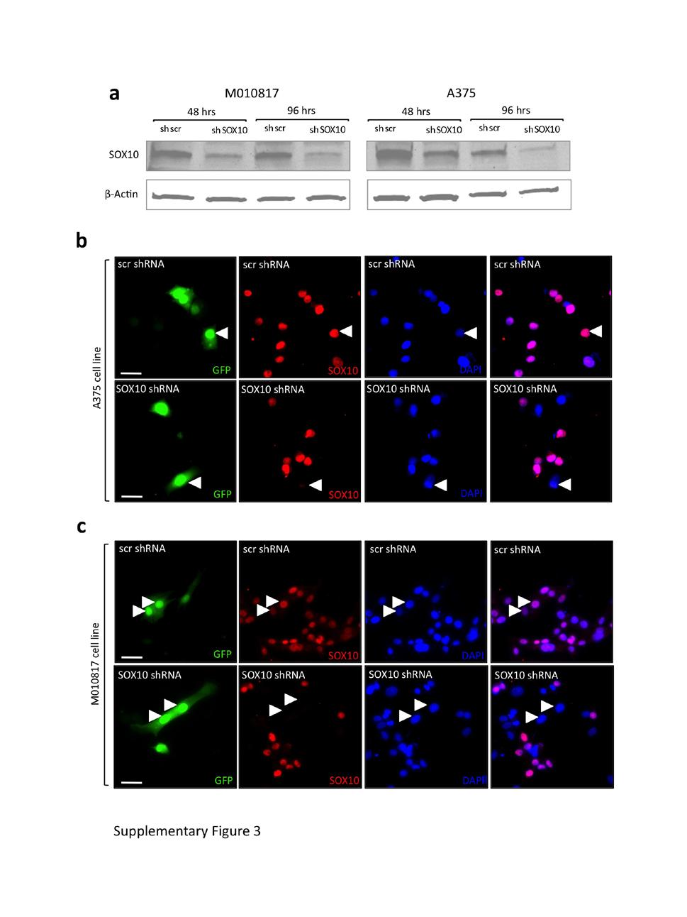 Figure S3 Characterization of SOX10 expression upon SOX10 knockdown in vitro in human melanoma cell lines.