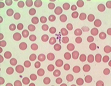 3. Platelets --smallest blood cells (fragments)