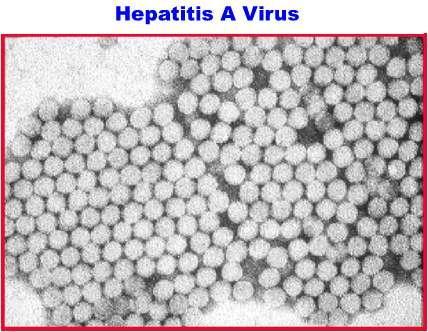 Background Information: Hepatitis A Virus (HAV) HAV is a picornavirus transmitted primarily through the fecal-oral route Incubation period: Average 30 days (range 15-50 days) Virus is shed