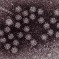 Norovirus/Norwalk like viruses