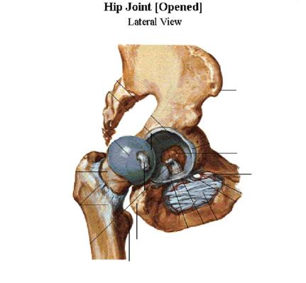 UW HEALTH SPORTS REHABILITATION Rehabilitation Guidelines for Open Hip Abductor (Gluteus Medius) Repair The hip joint is composed of the femur (the thigh bone) and the acetabulum (the socket which is