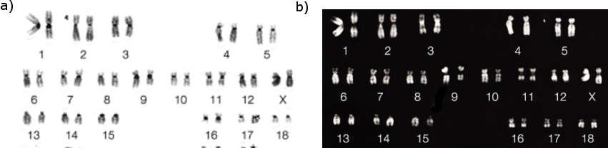 Chromosome Banding Revealed by Different Staining Techniques G-/Giemsa banding Q-banding R-banding C-banding 2001