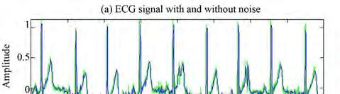 S. Chandramouleeswaran et al. / J. Biomedical Science and Engineering 5 (2012) **-** 711 the ECG signal whose peak has to be detected.