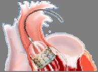 aorta Cerebrovascular