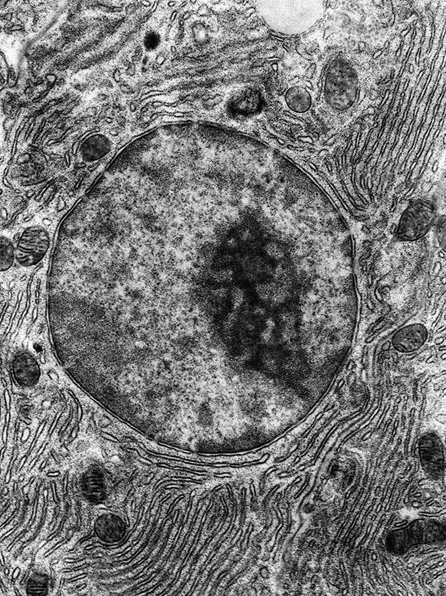 4 The electron micrograph shows part of an animal cell. 3 What will be synthesised in large quantities in this cell?