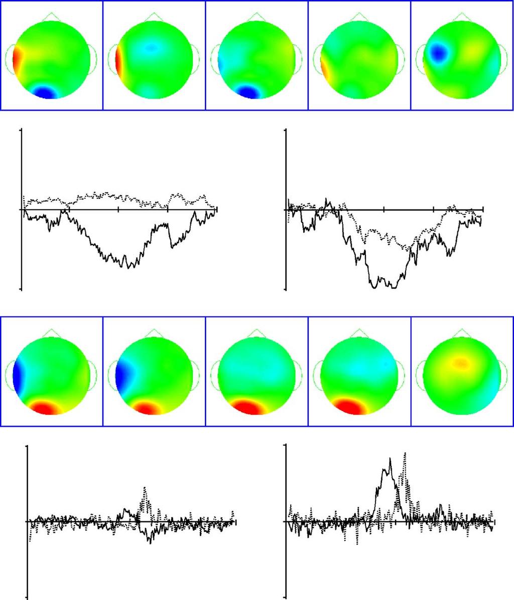 J.E. Richards / International Journal of Psychophysiology 54 (2004) 201 220 213 Fig. 6. First five ICA and PCA components for the Additive Sources, Temporal Overlap dataset.