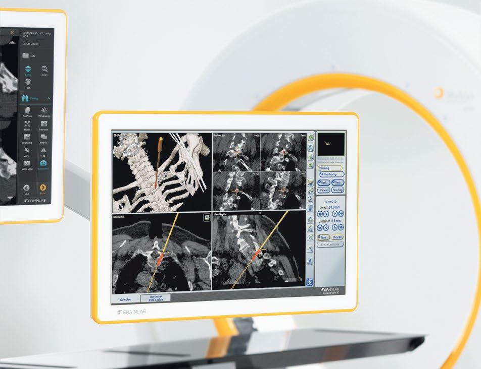 SIMPLE REGISTRATION PRACTICAL SIMPLICITY Navigation can be performed in any common image format from 2D and 3D images to MR, CT and robotic iangio 3D scans, regardless of pre- or intraoperative image