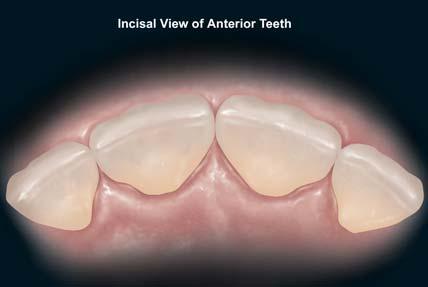 Practical Procedures & AESTHETIC DENTISTRY Figure 7. Illustration demonstrates the incisal aspect of the anterior dentition. Figure 8.