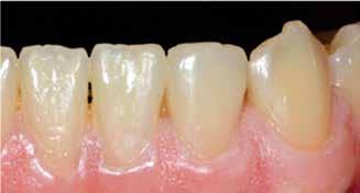 anterior dentition. Figure 4b.