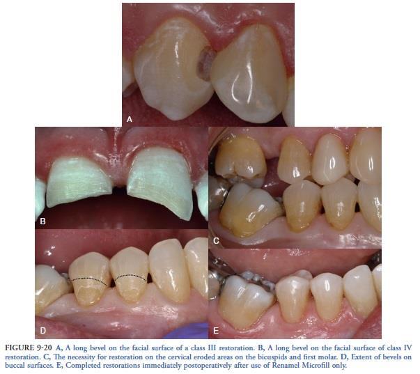 The importance of color: There are many techniques for color management. Shade taking has always been a problematic area for dentists.