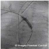 cardiologists (CIC) Coronary angiography