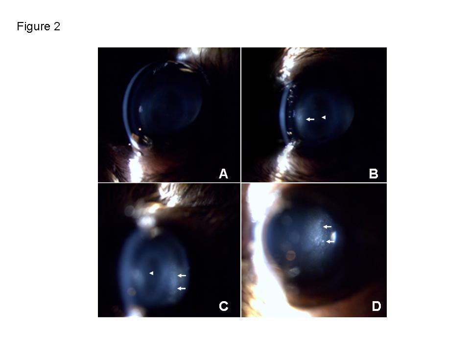 Supplementary Figure 2. Slit lamp biomicroscopy of a double knockout mouse of more than 12 months of age. (A) Clear cornea.