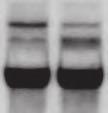 Supplemental Figure 2 Age Alb-c-Myc Northern Blot Total Liver RNA P28-42 Endogenous c-myc (E) c-myc Transgene (T) Albumin 1 2 3 4 Supplemental Figure 2.