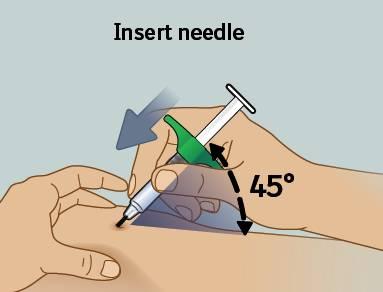 8) Insert needle Hold syringe at about a 45 degree angle to injection site, then insert
