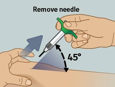 10) Remove needle from skin Remove needle from skin at the same angle you inserted it