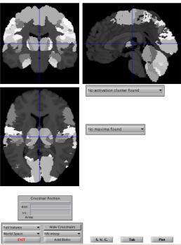 ; Cerebral Cortex 16, 268-279, 2006 premotor cortex, Area 6 Geyer, 2004 pyramidal tract Rademacher et al.