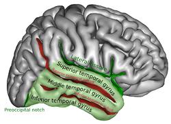 FMRI Studies! A variety of nonspeech control stimuli (frequency-modulated tones, amplitudemodulated noise) were introduced to identify areas that might be more speech-specific (e.g., Binder et al.