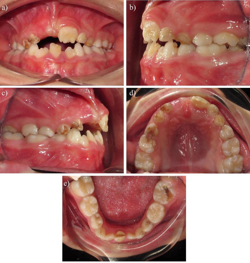 Figure 2: Intra-oral views before treatment.