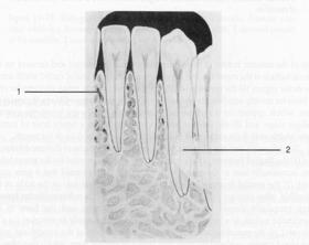 lower border of zygomatic arch 7. hamular process 8. maxillary tuberosity 9.