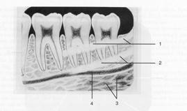 MANDIBULAR PREMOLAR AREA 1. mandibular torus 2. external oblique ridge 3. internal oblique ridge 4.