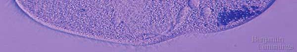 called a contractile vacuole, which
