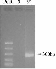 EFFECTIVE REMOVAL OF HIGH MOLECULAR WEIGHT RNA 63 precipitation can isolate genomic DNA that can be successfully amplified with the use of PCR (Figure 5). Figure 5.