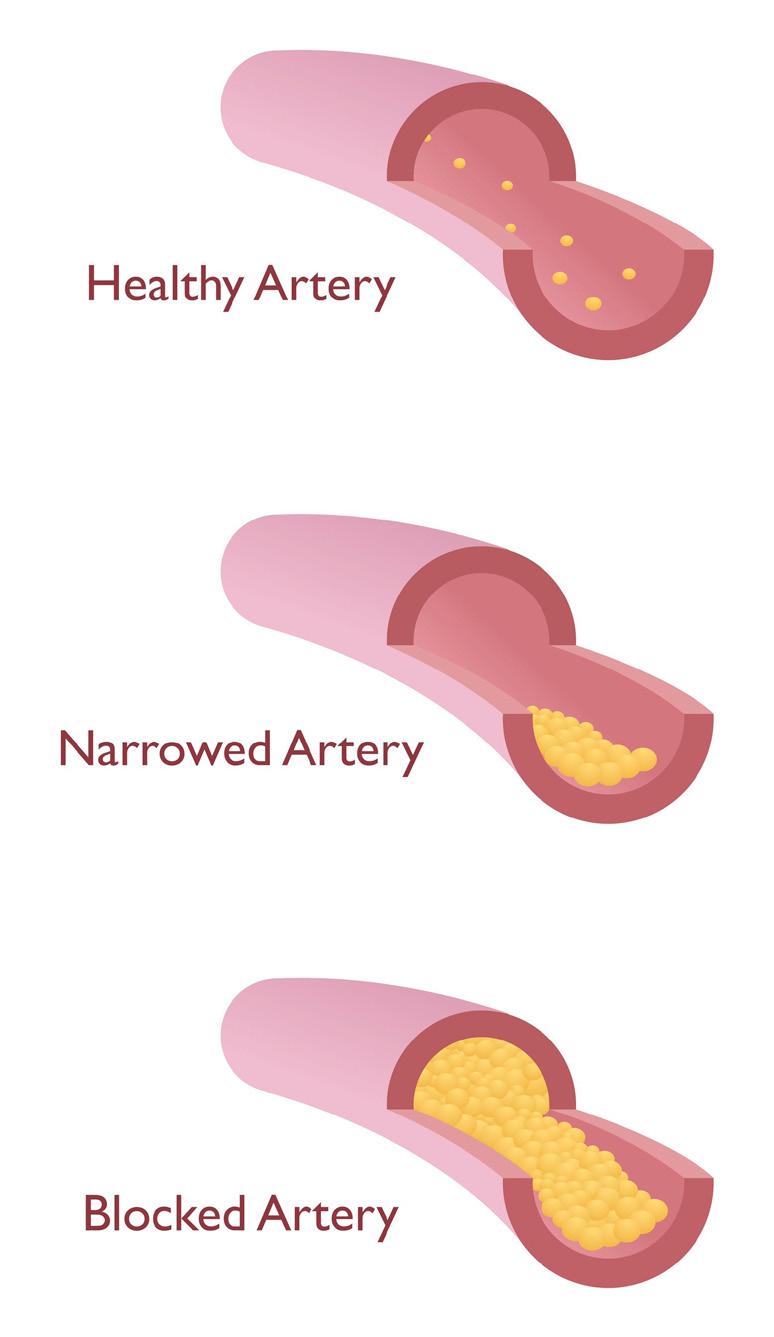 These are known as the coronary arteries and are pictured left. 12.